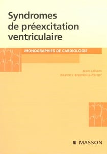 Syndromes de préexcitation ventriculaire