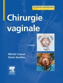 Chirurgie vaginale (2e édition)