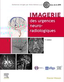 Imagerie des urgences neuroradiologiques