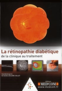 La retinopathie diabetique :de la clinique autraitement