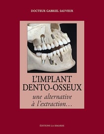 L'implant dento-osseux : une alternative à l'extraction...
