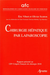 Chirurgie hépatique par Laparoscopie