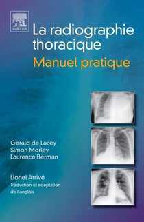 Radiographie du thorax