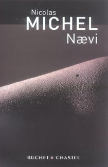 Naevi