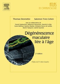 Dégénérescence maculaire liée à l'âge (2e édition)