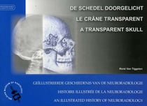 Le crâne transparent - histoire illustrée de la neuroradiologie