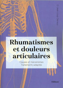 Rhumatismes et douleurs articulaires : causes et mécanismes, traitements adaptés - arthrose, sciatique, mal de dos