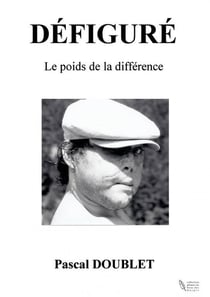 Défiguré - le poids de la différence