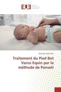 Traitement du Pied Bot Varus equin par la methode de Ponseti