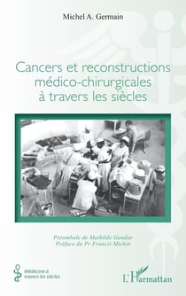Cancers et reconstructions medico-chirurgicales a travers les siecles