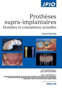 Prothèses supra-implantaires - données et conceptions actuelles