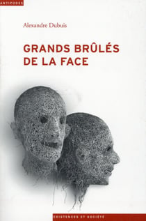 Grands brûlés de la face