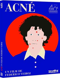Acné