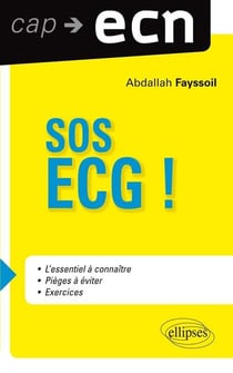 Sos ecg !