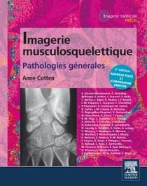 Imagerie musculosquelettique : pathologies générales (2e édition)