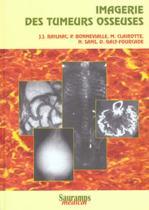 Imagerie des tumeurs osseuses