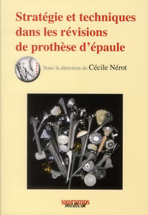 Stratégie et techniques dans les révisions de prothèse d'épaule