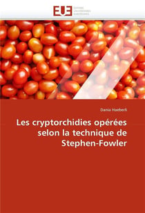 Les cryptorchidies operees selon la technique de stephen-fowler