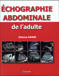 Échographie abdominale de l'adulte