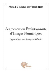 Segmentation évolutionniste d'images numériques - applications aux images médicales