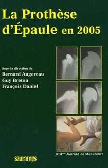 La prothèse d'épaule en 2005 - XIIIème journée de Menucourt