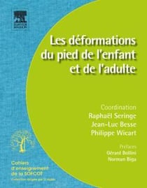 Les déformations du pied de l enfant et de l adulte
