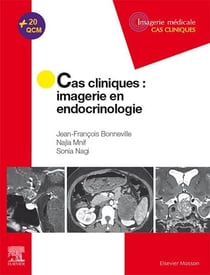 Cas cliniques : imagerie en endocrinologie
