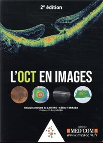 L'OCT en images (2e édition)