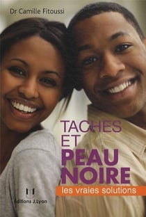 Taches et couleur de la peau noir - les vraies solutions