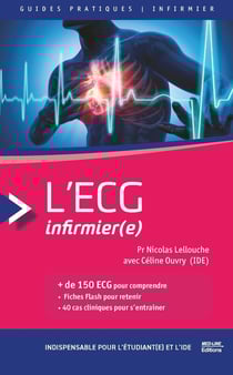 L'ECG INFIRMIER + DE 150 ECG