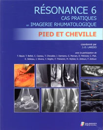 Resonance 6 - cas pratiques en imagerie rhumatologique - pied et cheville