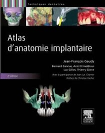 Atlas d'anatomie implantaire (2e édition)
