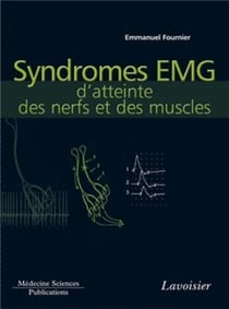 Syndromes EMG d'atteinte des nerfs et des muscles