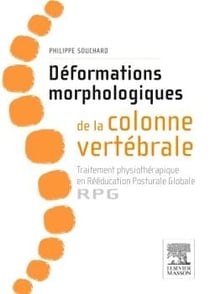 Déformation morphologique de la colonne vertébrale