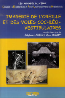 Imagerie de l'oreille et des voies cochléo-vestibulaires