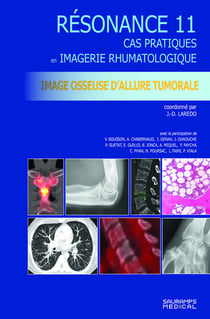 Résonance diagnostic en imagerie rhumatologique Tome 11 : Imagerie osseuse d'allure tumorale : Cas pratiques en imagerie musculosquelettique