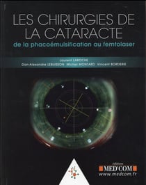 Les chirurgie de la cataracte. de la phacoemulsification au femtolaser