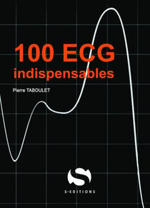 100 ecg indispensables