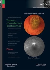 Tumeurs choroïdiennes et rétiniennes - divers
