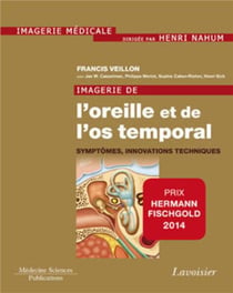Imagerie de l'oreille et de l'os temporal Tome 6 - symptômes, innovations techniques