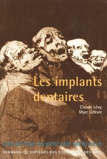 Implants dentaires (les)