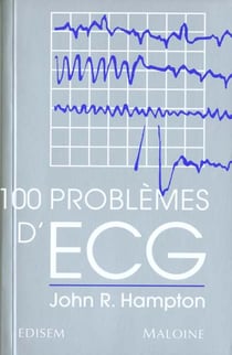 100 problemes d'ecg