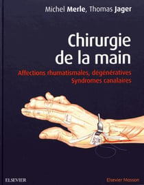 Chirurgie de la main - syndromes dégénératifs et canalaires (2e édition)