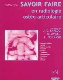 Savoir faire en radiologie ostéo-articulaire Tome 4