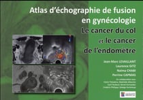 Atlas d'échographie de fusion en gynécologie - le cancer du col et le cancer de l'endomètre