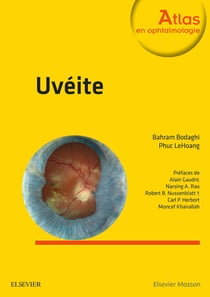 Uvéites (2e édition)