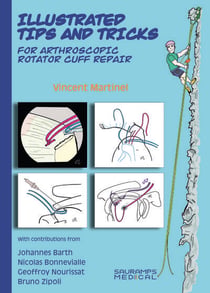 Illustrated tips & tricks for arthroscopic rotator cuff repair