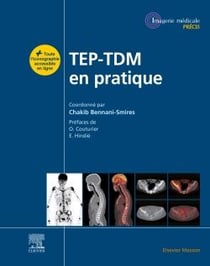 TEP-TDM en pratique