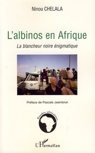 L'albinos en Afrique - la blancheur noire énigmatique