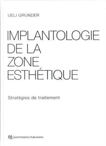 Implantologie de la zone esthétique - stratégies de traitement